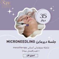 Microneedling Session