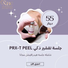Smart PRX-T PEEL Session