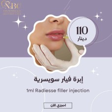 Radiesse filler