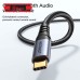  Hi-Fi Audio Cable Type-C to 3.5mm – Model SY-A07