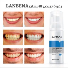 Foam teeth whitening