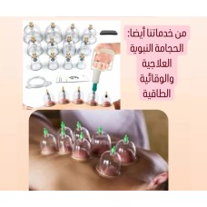 Cupping session