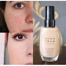 Foundation 