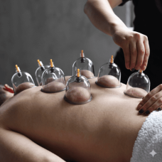  Cupping Therapy Session (Dry Cupping)